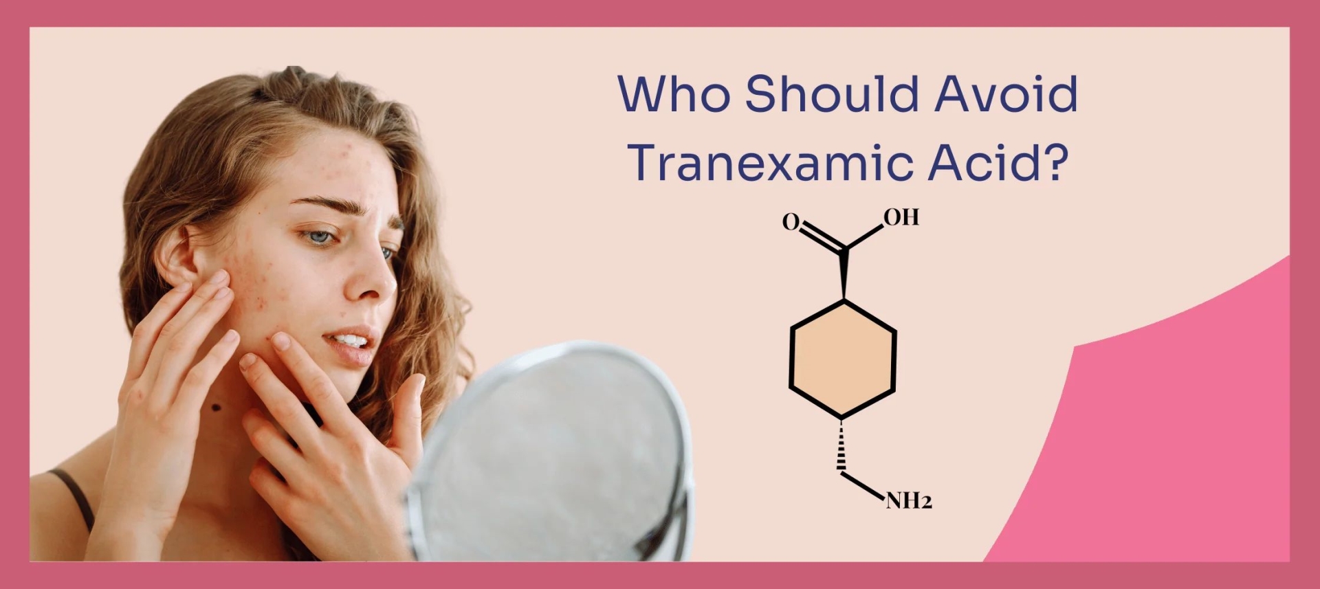 网红“氨甲环酸”被批准用于色斑治疗了吗？